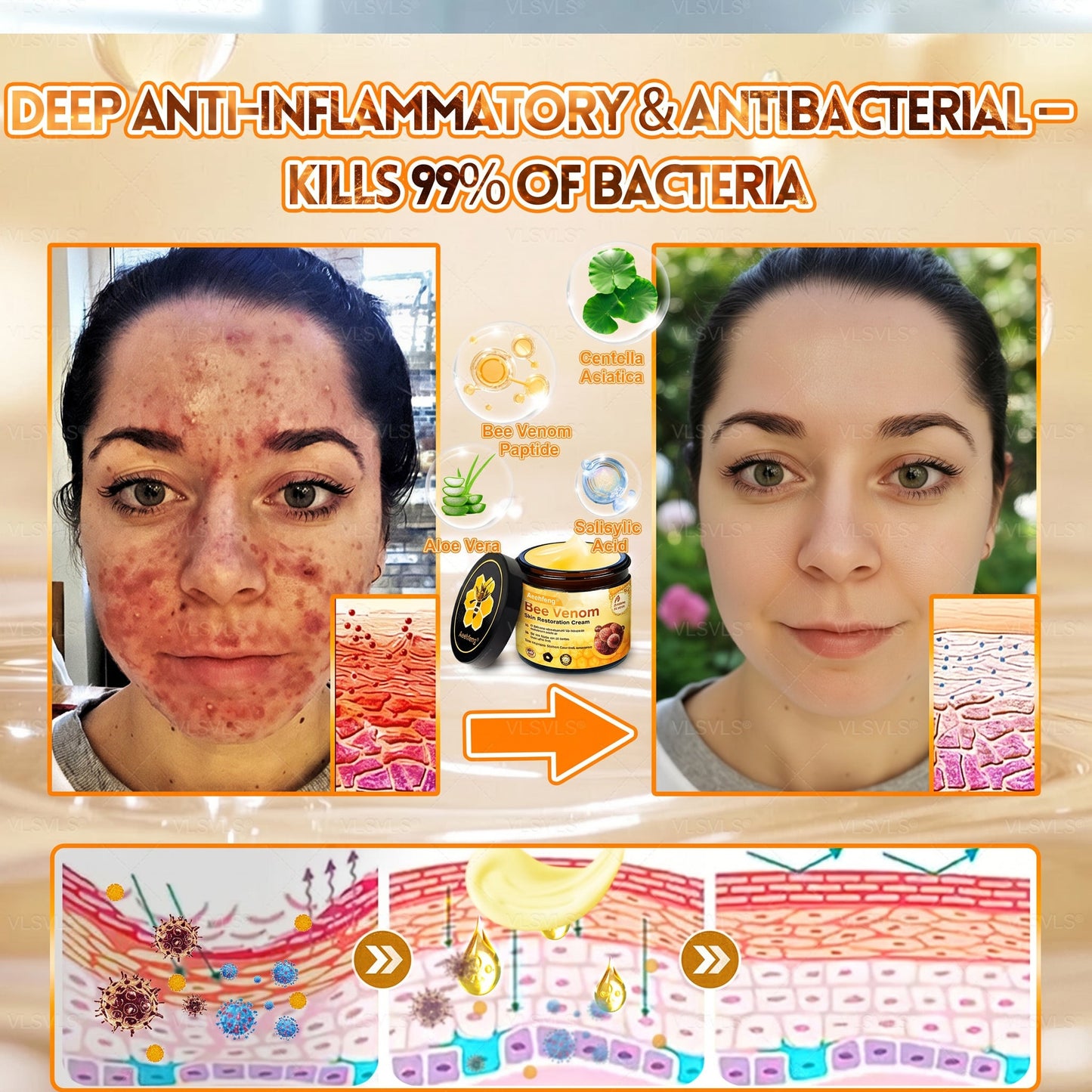🔥 LAST DAY 80% OFF🔥 Aeehfeng® Bee Venom Skin Restoration Cream